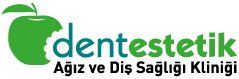 Dentestetik